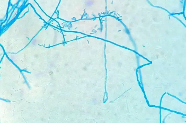 filamentous fungi